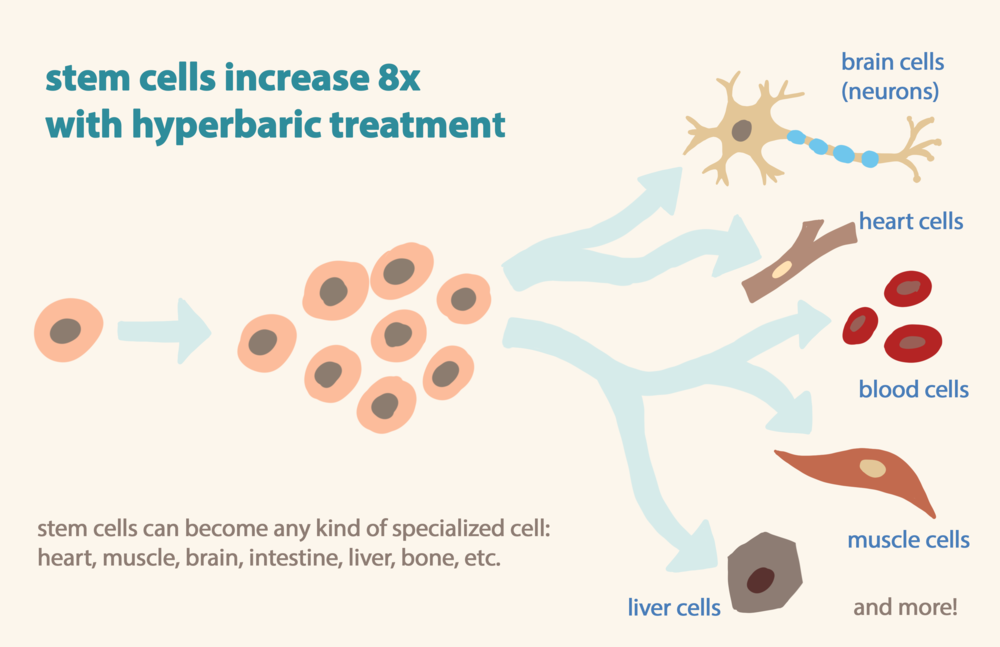 Increase The Effectiveness Of Stem Cell Therapy With HBOT 